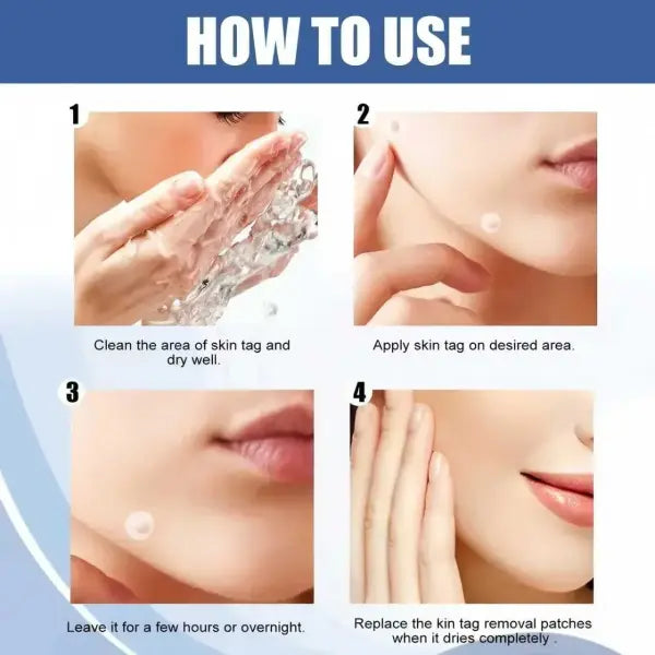 Star Pimple Patches Seven Color Hydrocolloid Dots – Gentle Acne Care