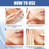 Star Pimple Patches Seven Color Hydrocolloid Dots – Gentle Acne Care