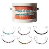 Fashion Braces Colorful Temporary Tooth Decoration Ligature Ties