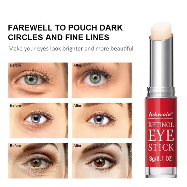 Retinol Eye Cream Stick 3g Anti-Aging Dark Circle Lightening Serum