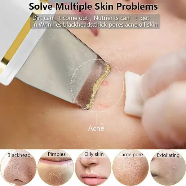 Ultrasonic Facial Scrubber for Deep Cleaning Skin Care Device