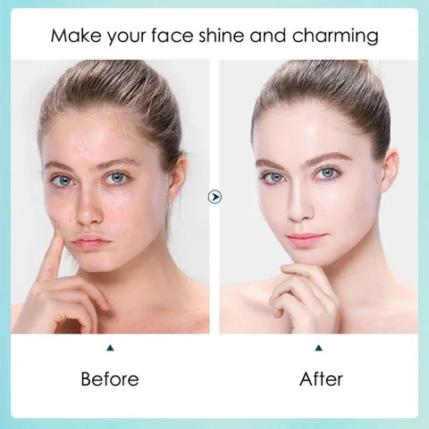 Hyaluronic Acid Hydrating Facial Mask Sheet for Moisture and Rejuvenation - Himpall