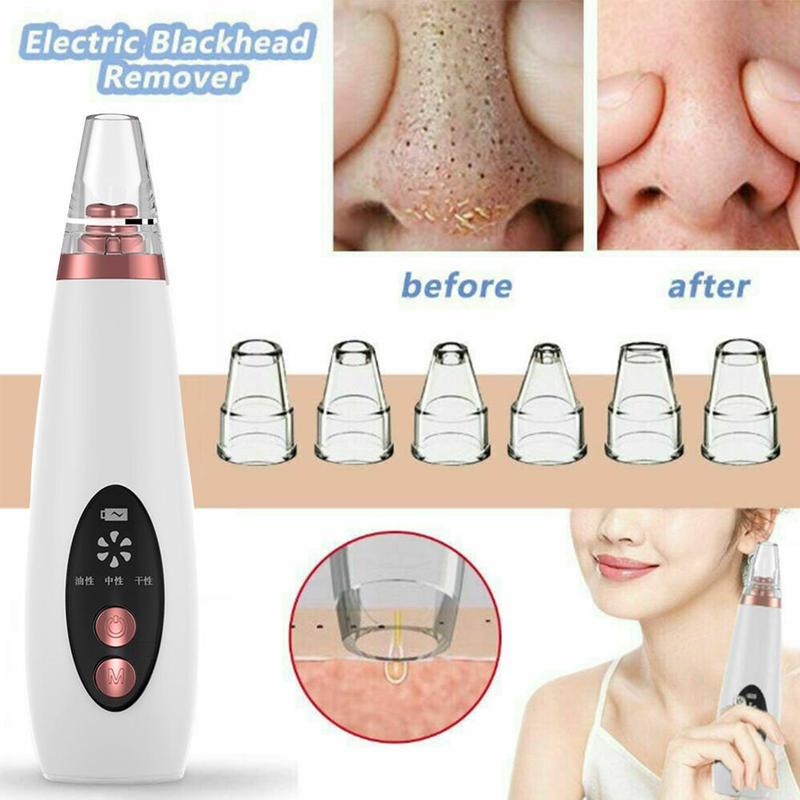 Blackhead Remover for Pore Cleansing – Effective Skin Care Tool