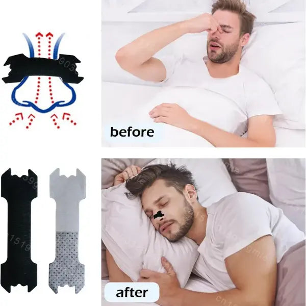 50/30/20PCS Anti-Snoring Nasal Strips – Breath Support Nose Patch for Better Sleep