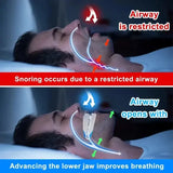 Adjustable Snoring Mouth Guard Clear Silicone Stop Snoring Device