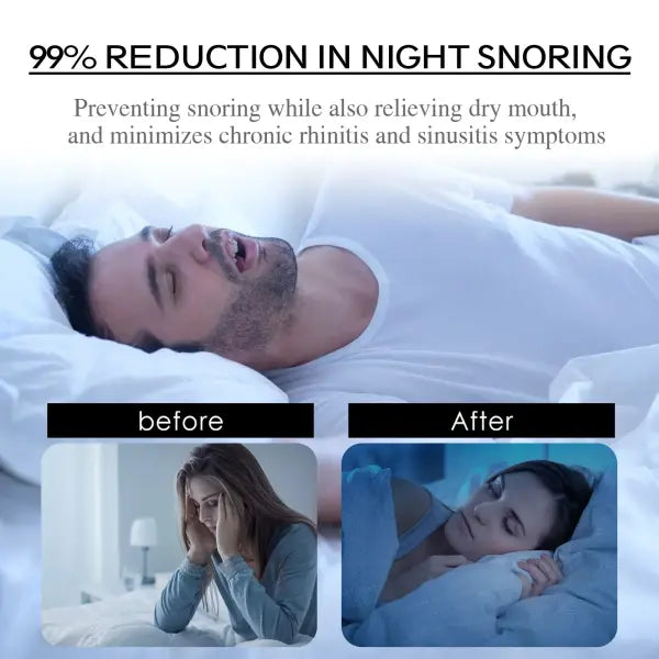 Anti-Snoring Mouth Tape – Nighttime Sleep Strip to Reduce Snoring & Improve Mouth Breathing for Adults