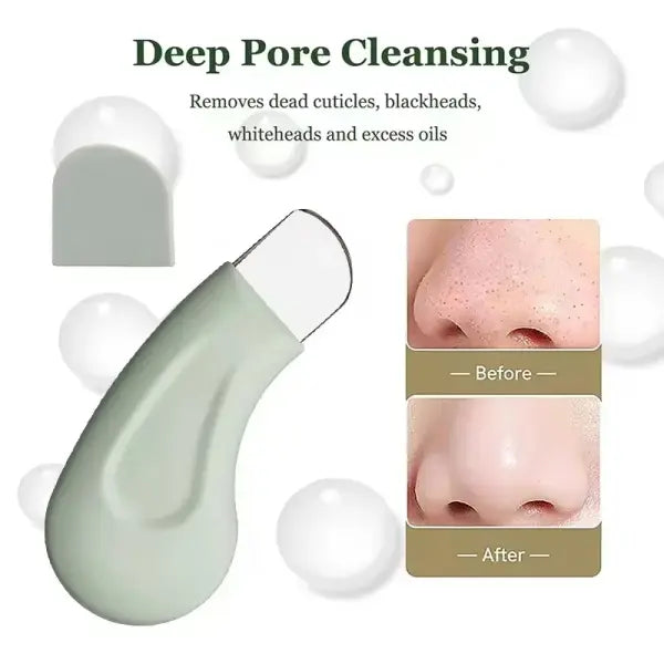 Blackhead and Whitehead Removal Tool for Nose and Face - Skin Pore Cleaner Skin Care Tools for Women - green-1pc