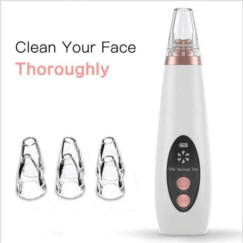 Blackhead Remover for Pore Cleansing – Effective Skin Care Tool