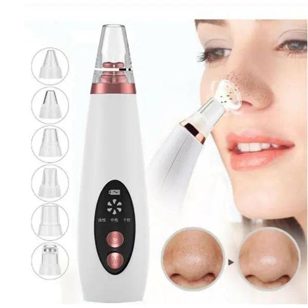 Blackhead Remover for Pore Cleansing – Effective Skin Care Tool