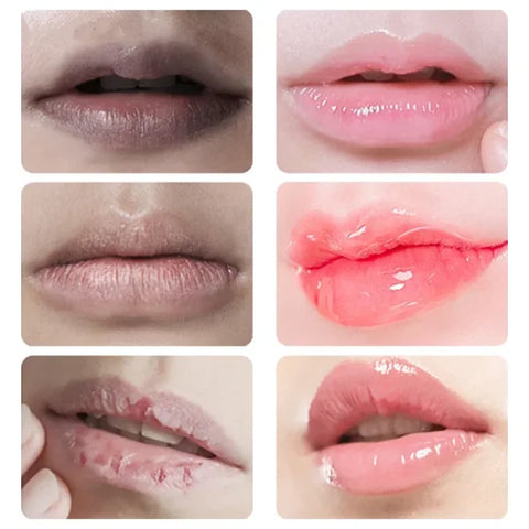 Remove Dark Lip Balm for Hydration and Melanin Lightening - Himpall