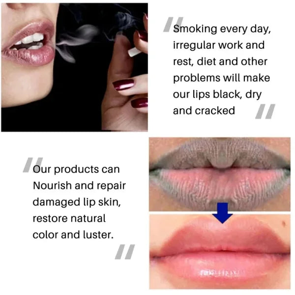 Remove Dark Lip Balm for Hydration and Melanin Lightening - Himpall