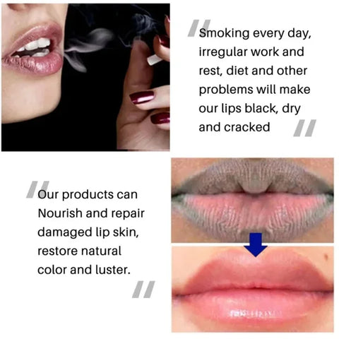 Remove Dark Lip Balm for Hydration and Melanin Lightening - Himpall