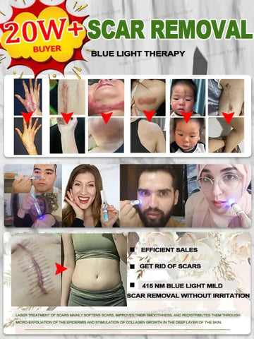 Remove various scars, stretch marks, surgical scars - Himpall