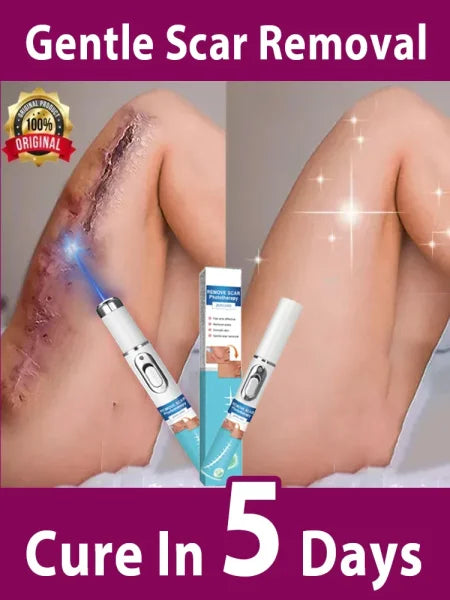 Remove various scars, stretch marks, surgical scars - Himpall