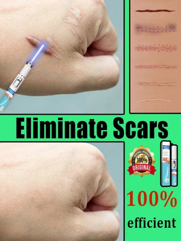 Remove various scars, stretch marks, surgical scars - Himpall
