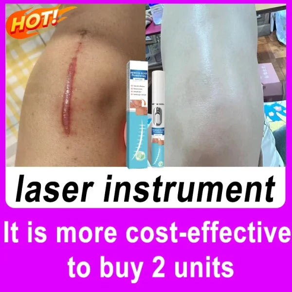 Remove various scars, stretch marks, surgical scars - Himpall