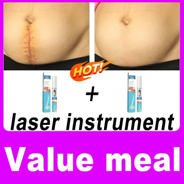 Remove various scars, stretch marks, surgical scars - Himpall
