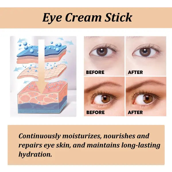 Snail Eye Cream Stick Collagen Fade Fine Lines Wrinkle Lightening Dark Circles Firming Eye Bags Puffiness Moisturizing
