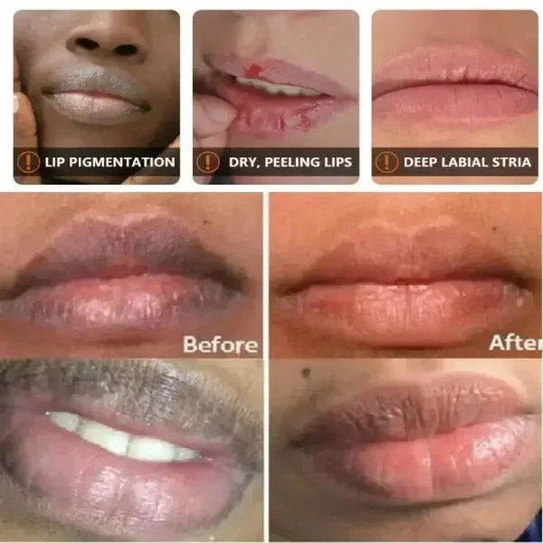 Turmeric Lip Balm for Restoring Pink Color and Reducing Dark Lips - Himpall
