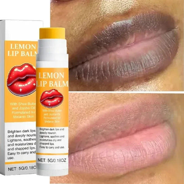 Turmeric Lip Balm for Restoring Pink Color and Reducing Dark Lips - Himpall