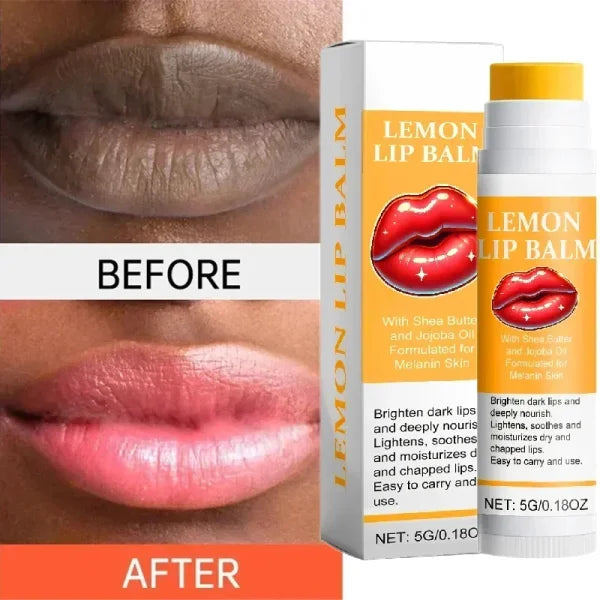 Turmeric Lip Balm for Restoring Pink Color and Reducing Dark Lips - Himpall