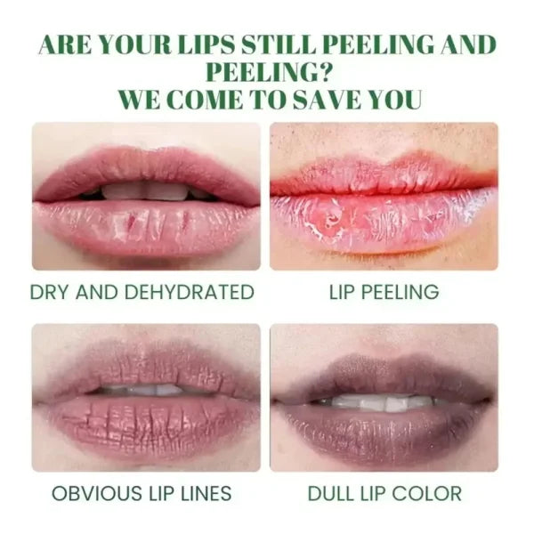 Turmeric Lip Balm for Restoring Pink Color and Reducing Dark Lips - Himpall