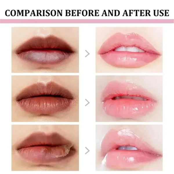 Turmeric Lip Balm for Restoring Pink Color and Reducing Dark Lips - Himpall