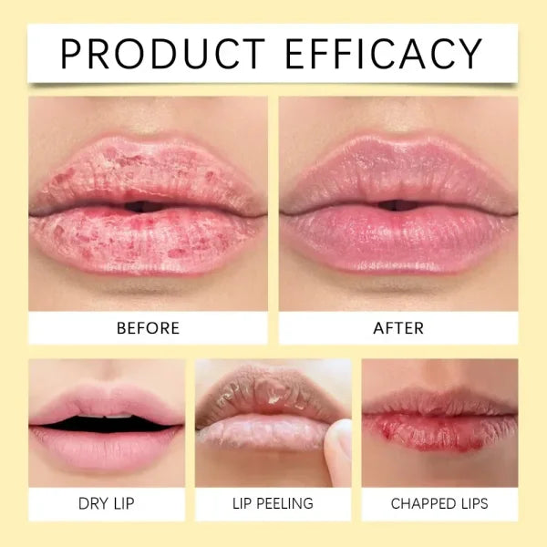 Turmeric Lip Balm for Restoring Pink Color and Reducing Dark Lips - Himpall